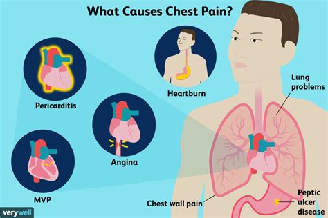 stabbing pain in chest